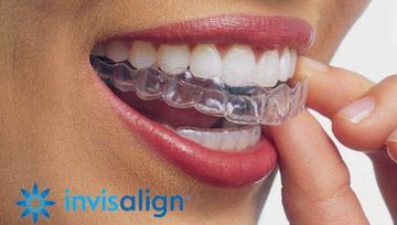 Invisalign